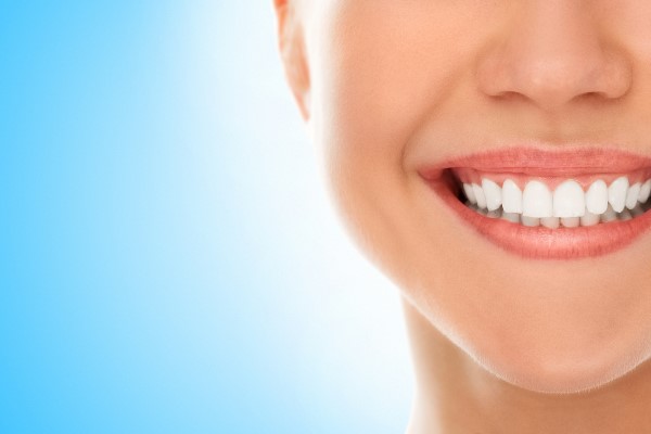 Dental Veneers