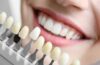 Cosmetic Dentistry