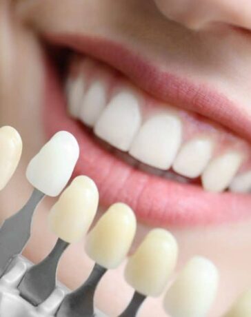 Cosmetic Dentistry