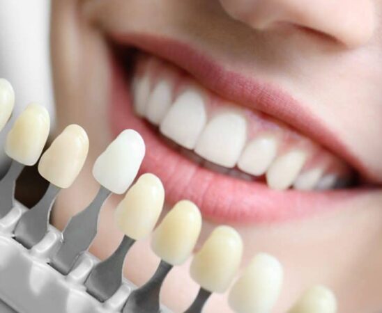 Cosmetic Dentistry