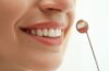 Evolution of Cosmetic Dentistry