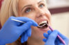 Oral Cancer Screening