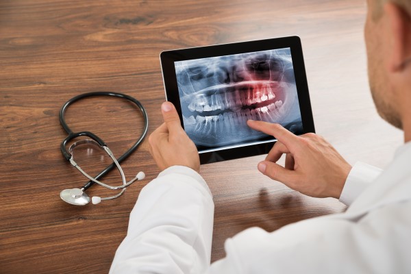 Oral Cancer Screening