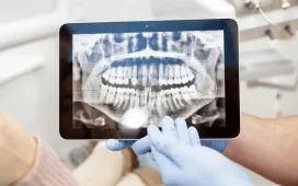 Radiographs in Dentistry