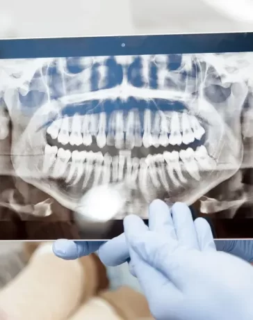 Radiographs in Dentistry