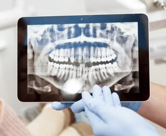 Radiographs in Dentistry