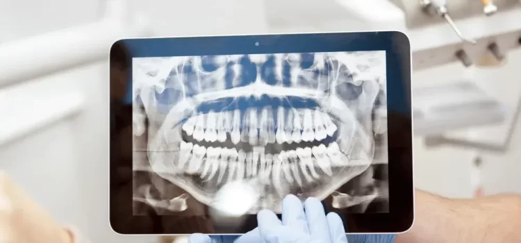 Radiographs in Dentistry