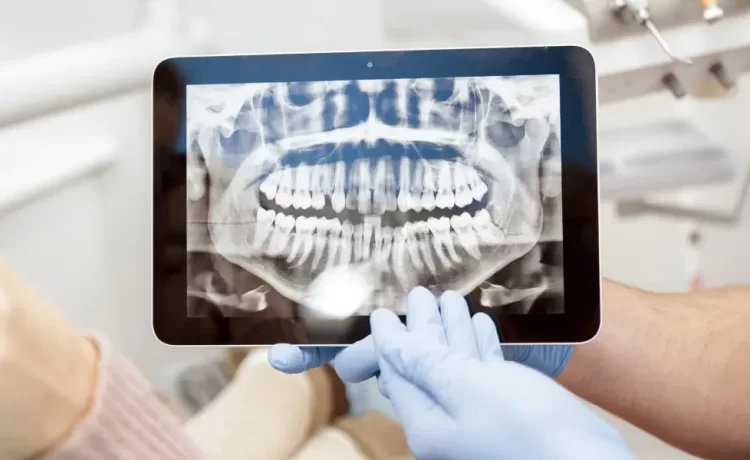 Radiographs in Dentistry